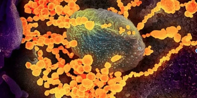 Ouest France. Le coronavirus peut survivre 28 jours sur un écran de smartphone ou un billet, selon une nouvelle étude