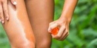 Le guide anti-moustique : tout savoir sur les piqûres de moustiques