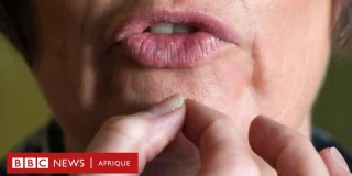 La cause mystérieuse du bégaiement dans le cerveau - BBC News Afrique